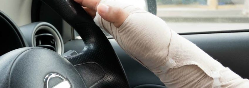 Safe to Drive After Surgery