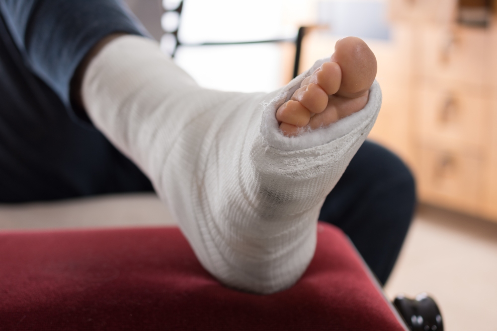 Woman wearing an Air Boot worn to support a fracture. On the other foot a high  heel shoe Stock Photo - Alamy