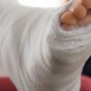 The Road to Recovery: Healing Time for a Spiral Fracture in the Fibula