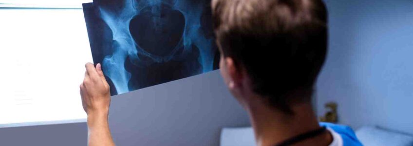 anterior labral tear hip treatment